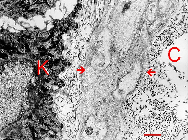 Fig. 5.22. Skin nerve below keratinocyte.gif