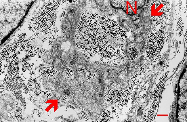Fig. 5.21. Skin nerve between cells of corium.gif