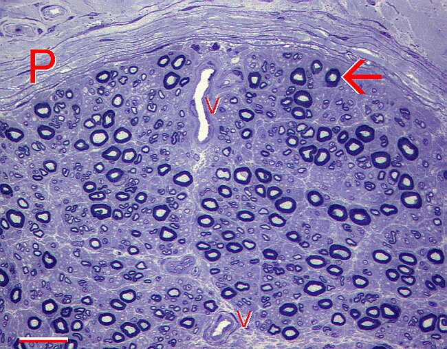 Fig. 5.20. Sural nerve in semithin epoxy-resin section.gif