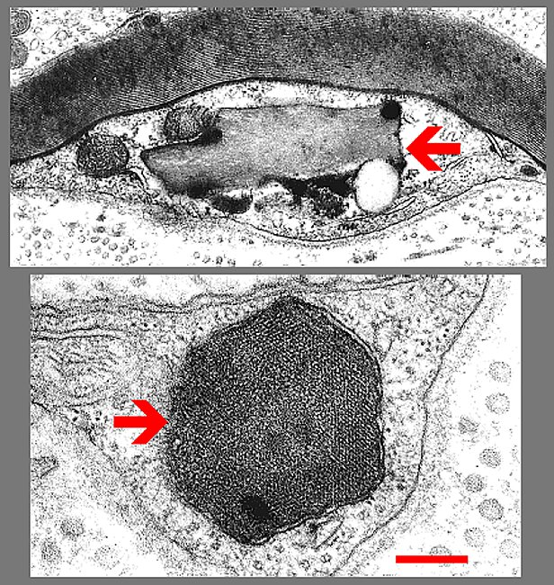 Fig. 5.16. Granules (of Reich) in Schwann cell.gif